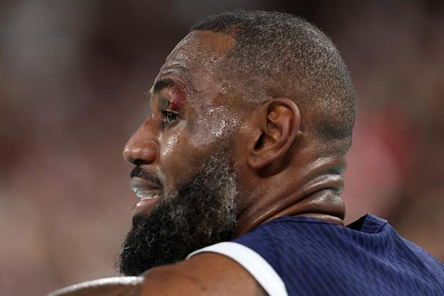 古巴拳击队员激烈对抗,成功晋级半决赛 古巴拳击队员激烈对抗,成功晋级半决赛